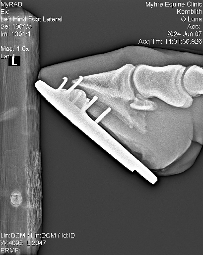 Luna Radiographs0001
